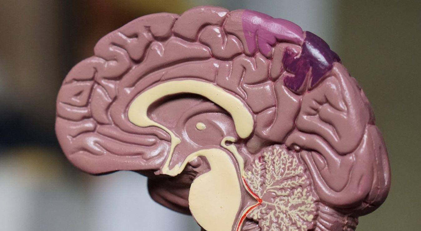 Model of the brain 